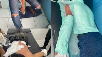 Tiga Mahasiswa Terbakar Saat Demo di Tanjung Selor, KAHMI dan HMI Desak Pengusutan Tuntas Insiden